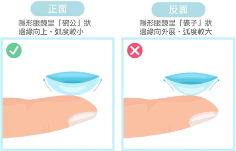 隱眼缺一角|隱形眼鏡不見會不會跑到眼球後？別亂摳眼！醫師教你。